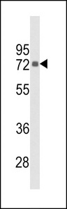 PIP5K1C Antibody - Western blot of hPIP5K1G-L652 in HeLa cell line lysates (35 ug/lane). PIP5K1G (arrow) was detected using the purified antibody.