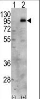 PIP5K1C Antibody - Western blot of PIP5K1C (arrow) using PIP5K1G Antibody. 293 cell lysates (2 ug/lane) either nontransfected (Lane 1) or transiently transfected with the PIP5K1C gene (Lane 2) (Origene Technologies).