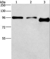 PIP5K1C Antibody - Western blot analysis of A431 and HeLa cell,mouse brain tissue, using PIP5K1C Polyclonal Antibody at dilution of 1:500.