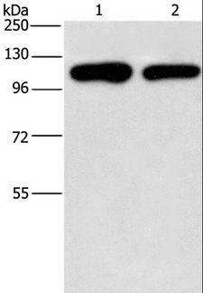 PIP5K1C Antibody - Western blot analysis of A431 and HeLa cell, using PIP5K1C Polyclonal Antibody at dilution of 1:500.