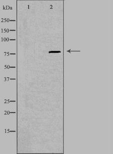 PIP5K1C Antibody - Western blot analysis of extracts of A549 cells using PIP5K1C antibody. The lane on the left is treated with the antigen-specific peptide.