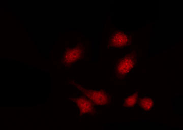 PIP5K1C Antibody - Staining A549 cells by IF/ICC. The samples were fixed with PFA and permeabilized in 0.1% Triton X-100, then blocked in 10% serum for 45 min at 25°C. The primary antibody was diluted at 1:200 and incubated with the sample for 1 hour at 37°C. An Alexa Fluor 594 conjugated goat anti-rabbit IgG (H+L) Ab, diluted at 1/600, was used as the secondary antibody.