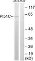 PIP5K1C Antibody - Western blot analysis of extracts from A549 cells, using PIP5K1C antibody.