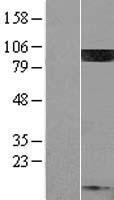 PIP5K1C Protein - Western validation with an anti-DDK antibody * L: Control HEK293 lysate R: Over-expression lysate