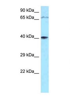 PIP5KL1 Antibody - PIP5KL1 antibody Western blot of 1 Cell lysate. Antibody concentration 1 ug/ml.  This image was taken for the unconjugated form of this product. Other forms have not been tested.