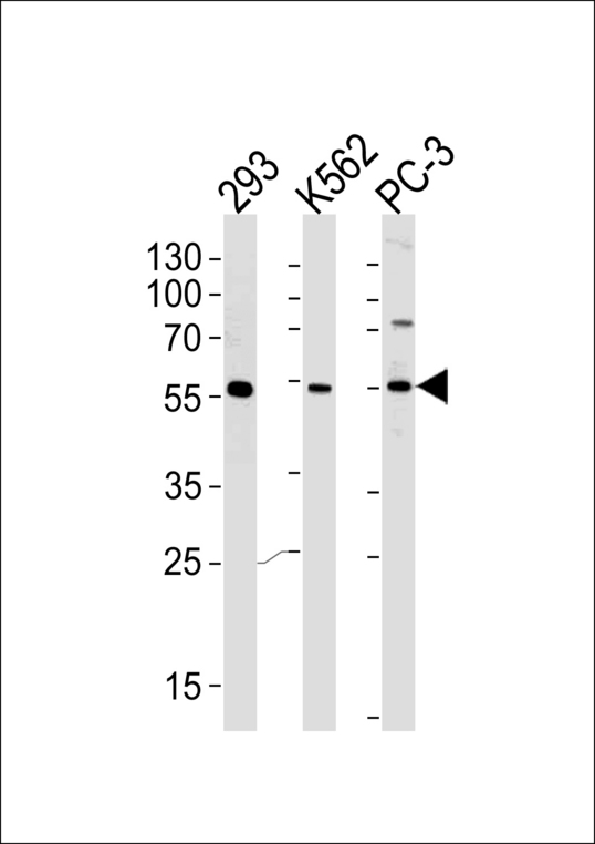 PIP5KL1 Antibody - Western blot of lysates from 293,K562,PC-3 cell line (from left to right),using PIP5KL1 Antibody. Antibody was diluted at 1:1000 at each lane. A goat anti-rabbit IgG H&L (HRP) at 1:5000 dilution was used as the secondary antibody.Lysates at 35ug per lane.