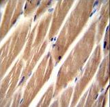 PIP5KL1 Antibody - PIP5KL1 Antibody immunohistochemistry of formalin-fixed and paraffin-embedded human skeletal muscle followed by peroxidase-conjugated secondary antibody and DAB staining.
