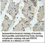 PIPOX / Sarcosine Oxidase Antibody