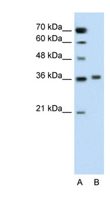 PIPOX / Sarcosine Oxidase Antibody - PIPOX antibody ARP42474_P050-NP_057602-PIPOX(pipecolic acid oxidase) Antibody Western blot of Jurkat lysate.  This image was taken for the unconjugated form of this product. Other forms have not been tested.