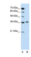PIPOX / Sarcosine Oxidase Antibody - PIPOX antibody ARP42474_P050-NP_057602-PIPOX(pipecolic acid oxidase) Antibody Western blot of Jurkat lysate.  This image was taken for the unconjugated form of this product. Other forms have not been tested.