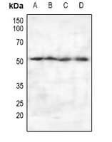 PIPOX / Sarcosine Oxidase Antibody - Western blot analysis of PSO expression in HepG2 (A), LO2 (B), PC12 (C), CT26 (D) whole cell lysates.