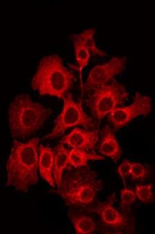 PIPOX / Sarcosine Oxidase Antibody - Staining NIH-3T3 cells by IF/ICC. The samples were fixed with PFA and permeabilized in 0.1% Triton X-100, then blocked in 10% serum for 45 min at 25°C. The primary antibody was diluted at 1:200 and incubated with the sample for 1 hour at 37°C. An Alexa Fluor 594 conjugated goat anti-rabbit IgG (H+L) Ab, diluted at 1/600, was used as the secondary antibody.