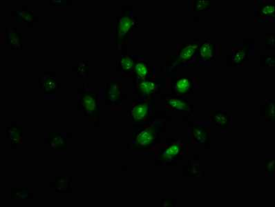 Pirin / PIR Antibody - Immunofluorescence staining of U251 cells with PIR Antibody at 1:100, counter-stained with DAPI. The cells were fixed in 4% formaldehyde, permeabilized using 0.2% Triton X-100 and blocked in 10% normal Goat Serum. The cells were then incubated with the antibody overnight at 4°C. The secondary antibody was Alexa Fluor 488-congugated AffiniPure Goat Anti-Rabbit IgG(H+L).