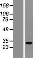 PITPNA Protein - Western validation with an anti-DDK antibody * L: Control HEK293 lysate R: Over-expression lysate