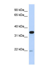 PITPNB Antibody - PITPNB antibody Western blot of Transfected 293T cell lysate. This image was taken for the unconjugated form of this product. Other forms have not been tested.