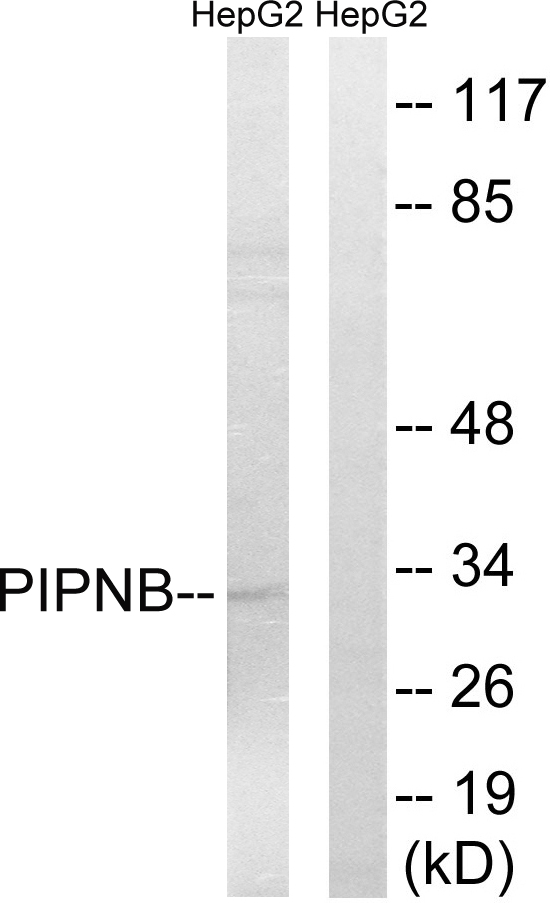 PITPNB Antibody - Western blot analysis of lysates from HepG2 cells, using PITPNB Antibody. The lane on the right is blocked with the synthesized peptide.
