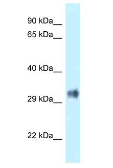 PITPNB Antibody - PITPNB antibody Western Blot of Fetal Brain. Antibody dilution: 1 ug/ml.  This image was taken for the unconjugated form of this product. Other forms have not been tested.
