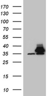 PITPNB Antibody - HEK293T cells were transfected with the pCMV6-ENTRY control. (Left lane) or pCMV6-ENTRY PITPNB. (Right lane) cDNA for 48 hrs and lysed. Equivalent amounts of cell lysates. (5 ug per lane) were separated by SDS-PAGE and immunoblotted with anti-PITPNB. (1:2000)