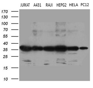 PITPNB Antibody - Western blot analysis of extracts. (35ug) from 6 different cell lines by using anti-PITPNB monoclonal antibody. (1:500)