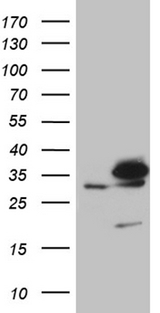 PITPNB Antibody - HEK293T cells were transfected with the pCMV6-ENTRY control. (Left lane) or pCMV6-ENTRY PITPNB. (Right lane) cDNA for 48 hrs and lysed