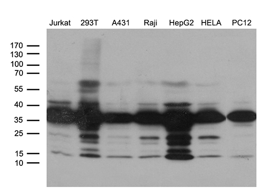 PITPNB Antibody - Western blot analysis of extracts. (35ug) from 7 different cell lines by using anti-PITPNB monoclonal antibody. (1:500)