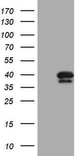 PITPNB Antibody - HEK293T cells were transfected with the pCMV6-ENTRY control. (Left lane) or pCMV6-ENTRY PITPNB. (Right lane) cDNA for 48 hrs and lysed