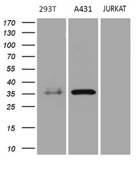 PITPNB Antibody - Western blot analysis of extracts. (35ug) from 3 different cell lines by using anti-PITPNB monoclonal antibody. (A431: human; 293T: human; Jurkat: human). (1:500)