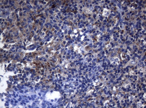 PITPNB Antibody - Immunohistochemical staining of paraffin-embedded Human lymph node tissue within the normal limits using anti-PITPNB mouse monoclonal antibody. (Heat-induced epitope retrieval by 1mM EDTA in 10mM Tris buffer. (pH8.5) at 120°C for 3 min. (1:150)