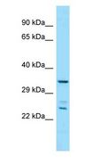PITPNC1 Antibody - PITPNC1 antibody Western Blot of Mouse Small Intestine.  This image was taken for the unconjugated form of this product. Other forms have not been tested.