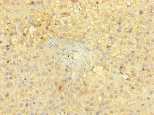 PITPNC1 Antibody - Immunohistochemistry of paraffin-embedded human adrenal gland tissue using PITPNC1 Antibody at dilution of 1:100