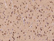 PITPNC1 Antibody - Immunochemical staining of human PITPNC1 in human brain with rabbit polyclonal antibody at 1:100 dilution, formalin-fixed paraffin embedded sections.