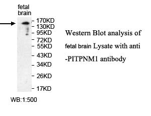 PITPNM1 / NIR2 Antibody