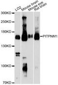 PITPNM1 / NIR2 Antibody - Western blot analysis of extracts of various cell lines, using PITPNM1 Antibody at 1:3000 dilution. The secondary antibody used was an HRP Goat Anti-Rabbit IgG (H+L) at 1:10000 dilution. Lysates were loaded 25ug per lane and 3% nonfat dry milk in TBST was used for blocking. An ECL Kit was used for detection and the exposure time was 90s.