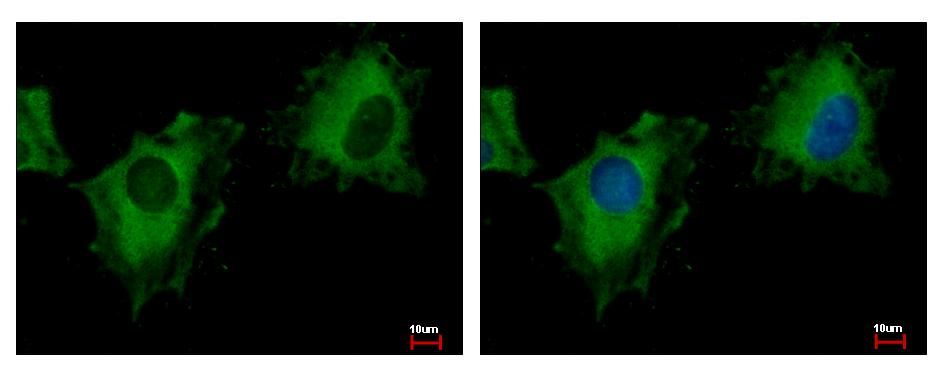 PITPNM3 / NIR1 Antibody - NIR1 antibody [C3], C-term detects PITPNM3 protein at cytoplasm by immunofluorescent analysis. HeLa cells were fixed in -20 100% MeOH for 5 min. PITPNM3 protein stained by NIR1 antibody [C3], C-term diluted at 1:500. 