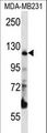 PITRM1 / MP1 Antibody - PITRM1 Antibody western blot of MDA-MB231 cell line lysates (35 ug/lane). The PITRM1 antibody detected the PITRM1 protein (arrow).
