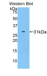 PITRM1 / MP1 Antibody - Western blot of recombinant PITRM1 / MP1.  This image was taken for the unconjugated form of this product. Other forms have not been tested.