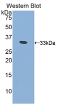 PITRM1 / MP1 Antibody - Western Blot; Sample: Recombinant protein.