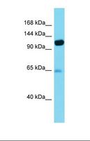 PITRM1 / MP1 Antibody - Western blot of Human Thyroid Tumor. PITRM1 antibody dilution 1.0 ug/ml.  This image was taken for the unconjugated form of this product. Other forms have not been tested.