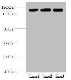 PITRM1 / MP1 Antibody - Western blot All Lanes:PITRM1 antibody at 2ug/ml Lane 1:mouse placenta tissue Lane 2:A549 whole cell lysate Lane 3:mouse kidney tissue Secondary Goat polyclonal to rabbit at 1/10000 dilution Predicted band size: 118,107 kDa Observed band size: 117 kDa