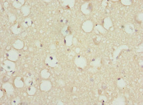 PITRM1 / MP1 Antibody - Immunohistochemistry of paraffin-embedded human brain tissue at dilution 1:100