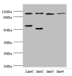 PITRM1 / MP1 Antibody - Western blot All Lanes:PITRM1 antibody at 2.42ug/ml Lane 1:mouse placenta tissue Lane 2:A549 whole cell lysate Lane 3:rat gonad tissue Lane 4:mouse kidney tissue Secondary Goat polyclonal to rabbit at 1/10000 dilution Predicted band size: 118,107 kDa Observed band size: 117 kDa,50 kDa