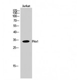 PITX1 Antibody - Western blot of Pitx1 antibody