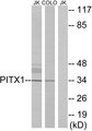 PITX1 Antibody - Western blot analysis of lysates from Jurkat and COLO cells, using PITX1 Antibody. The lane on the right is blocked with the synthesized peptide.