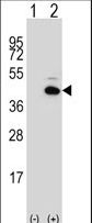 PITX1 Antibody - Western blot of PITX1 (arrow) using rabbit polyclonal PITX1 Antibody. 293 cell lysates (2 ug/lane) either nontransfected (Lane 1) or transiently transfected (Lane 2) with the PITX1 gene.