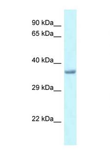 PITX1 Antibody - PITX1 antibody Western blot of Rat Liver lysate. Antibody concentration 1 ug/ml.  This image was taken for the unconjugated form of this product. Other forms have not been tested.
