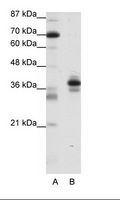 PITX1 Antibody - A: Marker, B: Jurkat Cell Lysate.  This image was taken for the unconjugated form of this product. Other forms have not been tested.