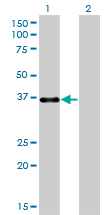 PITX1 Antibody - Western Blot analysis of PITX1 expression in transfected 293T cell line by PITX1 monoclonal antibody (M01), clone 5G4.Lane 1: PITX1 transfected lysate(34.1 KDa).Lane 2: Non-transfected lysate.