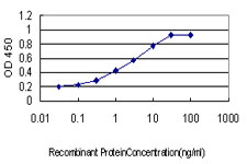 PITX1 Antibody - Detection limit for recombinant GST tagged PITX1 is approximately 0.03 ng/ml as a capture antibody.
