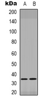 PITX1 Antibody - Western blot analysis of PITX1 expression in Jurkat (A); NIH3T3 (B) whole cell lysates.