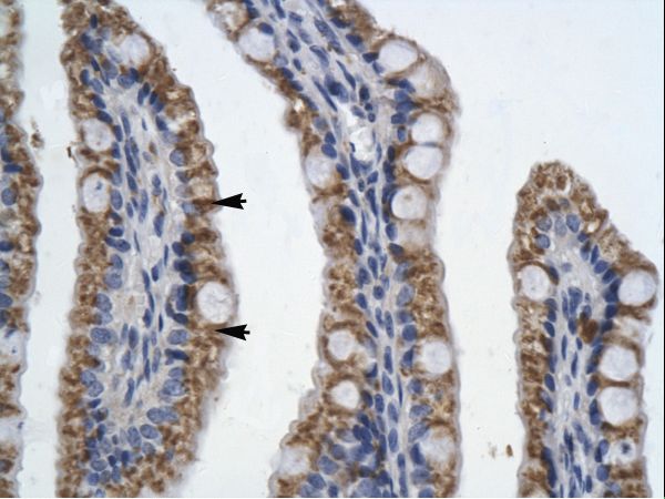 PITX2 / RGS Antibody - PITX2 antibody ARP35634_T100-NP_000316-PITX2 (paired-like homeodomain transcription factor 2) Antibody was used in IHC to stain formalin-fixed, paraffin-embedded human intestine.  This image was taken for the unconjugated form of this product. Other forms have not been tested.
